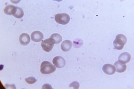 The Malaria parasite. A team of MIT biological engineers has developed a method to measure levels of the iron-containing protein heme inside the malaria parasite.
