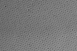 This high-resolution transmission electron micrograph of particles made by the research team shows the particles’ highly uniform size and shape. These are iron oxide particles just 3 nanometers across, coated with a zwitterion layer. Their small size means they can easily be cleared through the kidneys after injection.
