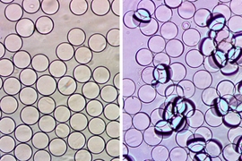 At left, Janus droplets viewed from above. After the droplets encounter their target, a bacterial protein, they clump together (right).