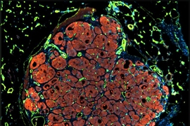 Researchers have developed a new way to engineer liver tissue by organizing tiny subunits that contain three types of cells embedded into a biodegradable tissue scaffold. This image shows vascularized engineered human liver tissue that has self-organized into a lobule-like microstructure.
