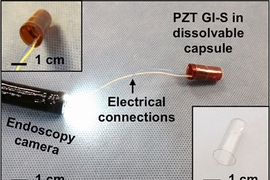 This type of sensor could make it easier to diagnose digestive disorders that impair motility of the digestive tract, which can result in difficulty swallowing, nausea, gas, or constipation. 

