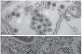 Electron microscope images of marine bacteria infected with the non-tailed viruses studied in this research. The bacterial cell walls are seen as long double lines, and the viruses are the small round objects with dark centers.
