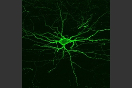 MIT researchers have developed a light-sensitive protein that can be embedded into neuron membranes, where it emits a fluorescent signal that indicates how much voltage a particular cell is experiencing. This could allow scientists to study how neurons behave, millisecond by millisecond, as the brain performs a particular function.