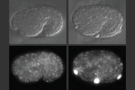 Biologists compared C. elegans embryos missing the alfa-1 gene, right, to those with the gene, left.  At bottom right, abnormal blobs of yolk labeled with a fluorescent protein can be seen in the embryo lacking alfa-1.