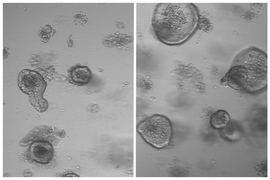 Intestinal stem cells from mice that fasted for 24 hours, at right, produced much more substantial intestinal organoids than stem cells from mice that did not fast, at left.