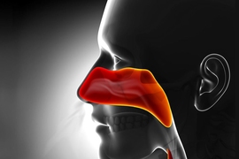Chronic rhinosinusitis causes the sinuses to become inflamed and swollen for months to years at a time, leading to difficulty breathing and other symptoms.