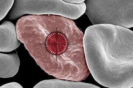 MIT biologists have discovered that in some patients, immune cells called natural killer cells fail to kill malaria-infected red blood cells (shown here).