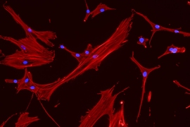 MIT engineers grew these mesenchymal stem cells (red, with blue nuclei) on a surface with mechanical properties similar to those of bone marrow.