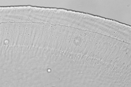 This image, taken through an optical microscope, shows a cross-section of the tectorial membrane, a gelatinous structure that lies atop the tiny hairs that line the inner ear.