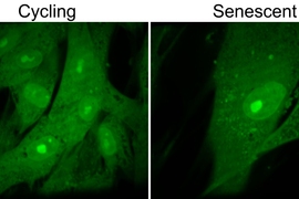 MIT researchers found that when they halted cell division in human fibroblast cells, they became abnormally large and then entered a non-dividing state known as senescence (right panel). Untreated, normal-sized fibroblasts are shown at left.