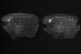 By exposing mice to a unique combination of light and sound, MIT neuroscientists have shown that they can improve cognitive and memory impairments similar to those seen in Alzheimer’s patients. At left, the mouse cortex shows a reduction in amyloid plaques following visual and auditory stimulation, compared to the untreated mouse at right.