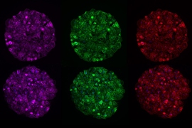 MIT researchers have developed an engineered liver tissue model that can be manipulated with RNA interference (RNAi).