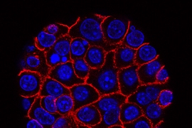 Pancreatic cancer cells (nuclei in blue) growing as a sphere encased in membranes (red). By growing cancer cells in the lab, researchers can study factors that promote and prevent the formation of deadly tumors.