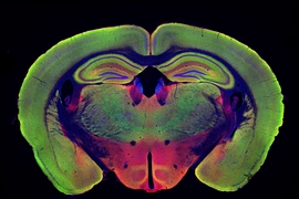 At left is the brain of a mouse genetically programmed to develop Alzheimer’s disease. At right, the brain of a mouse programmed to develop the disease, but treated with noninvasive visual stimulation, shows much less neurodegeneration.