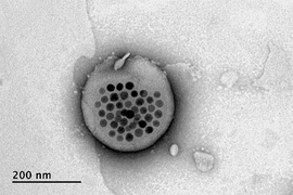 Electron microscope image shows the actual liposome, the white blob at center, with its magnetic particles showing up in black at its center. 