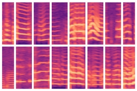 A new MIT-developed model automates a critical step in using AI for medical decision making, where experts usually identify important features in massive patient datasets by hand. The model was able to automatically identify voicing patterns of people with vocal cord nodules (shown here) and, in turn, use those features to predict which people do and don’t have the disorder.