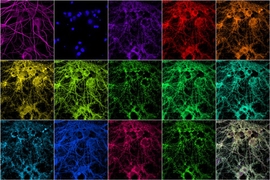 Researchers at MIT and the Broad Institute of MIT and Harvard have devised a new way to rapidly image synaptic proteins at high resolution. Using fluorescent nucleic acid probes, they can label and image as many as 12 different proteins in neuronal samples containing thousands of synapses.