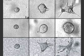 A tumor’s invasiveness depends on its water content and the stiffness of its exterior. In the top row, a tumor progresses normally toward an invasive profile. If water is drawn out of the same tumor (middle row), it is less invasive, compared to when the tumor is infused with water (bottom row), causing it to quickly burst and invade surrounding tissue.