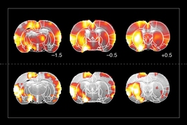 MIT biological engineers have created a specialized sensor that allows them to track dopamine in the brain using magnetic resonance imaging (MRI), as shown in the bottom row. Images in the top row show overall brain activity, as measured by functional MRI.