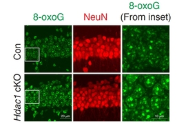 In this figure, neurons in the bottom row, which are missing the HDAC1 gene, show higher levels of DNA damage (green) than normal neurons.