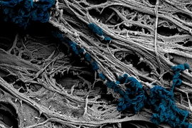 A scanning electron microscope image of cultured neural cells shows the team’s newly developed nanodiscs (colored area) arrayed along the cell surface, where they can exert enough force to trigger a response.