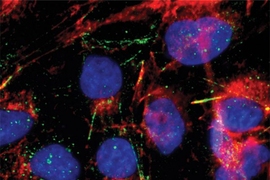 RNA-binding proteins (green) are visible in these hepatocyte carcinoma cells. The cell nuclei are labeled blue, and actin proteins are labeled red.