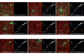 DEEP-TFM imaging of cortical vasculature