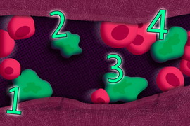 This illustration shows red blood cells in a vein. Four green wobbly tumor cells are present, and each is numbered with a bright green number.