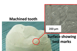 tooth composite