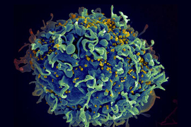 HIV viruses