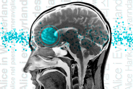 a brain scan with Broca's area labeled in blue