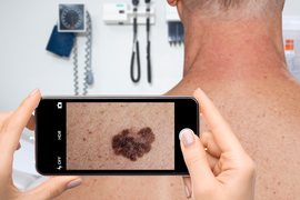 a doctor uses Piction to take a picture of a possible skin condition