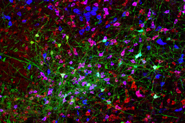 A fluorescent image with green neurons with additional blue and red elements.