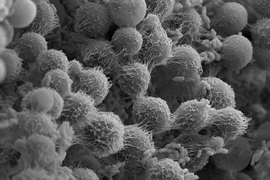 Grey microscope image shows a densely populated microbial community, with many ball-shaped microbes close together connected by web-like tendrils in different textures, and also smaller pill-shaped microbes in many areas.