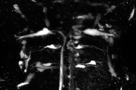 Monochrome fish neurons that look like white blobs with threads coming out, some joining a vertical structure.