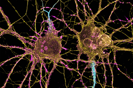 2 neurons on black background, with colorful pink, blue, and yellow strands emanating from them.