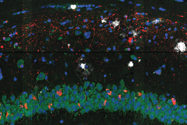 2 microscopy images show blotches of red, blue, green, and white on black background. On bottom, green and blue blotches form a horizontal rope-like figure.