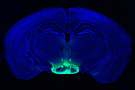 A blue-stained image of a brain where you can see both hemispheres. The bottom center of the brain is stained seafoam green to highlight the mammillary body inside the hypothalamus.