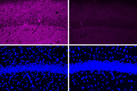 4 panels, with two stained purple on top and two stained blue on bottom. In the top two, there is a significant decrease in the purple color, which represents Tau proteins, and the top right is darker and much less purple. The bottom two panels are very similar, and show nuclei as bright blue bits, like pebbles. A thick band of the blue bits across the center of the panels.