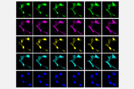 A 5 by 5 sequence of images showing cells represented by different colors in transition.