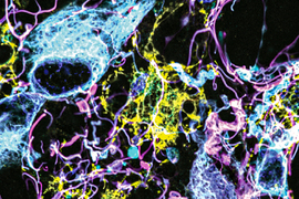 Colorful, squiggly brain tissue on a dark background. It includes yellow streaks and speckles, light blue globs with dark blue inside of them, and curly lines of pink.