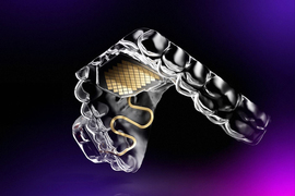 safari trackpad gestures not working A rendering of the device, like a mouth retainer with a gold sensor on the palate