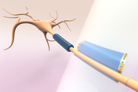 The cord-like part of the neuron has two devices wrapped around it, like a piece of tape.