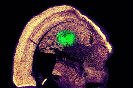 Scan of brain, with a circle of green neurons.