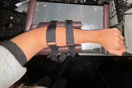 A person wearing the glucose monitor on their forearm