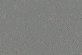 Animation shows, over 5 hours, red dots indicating killed cancer cells.