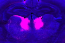 Brain image highlighted pink in the center