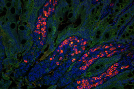 Intestinal cells show red spots in microscopic view