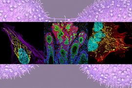 Three screens of colorful cancer cells