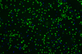 Green dots and smaller blue dots